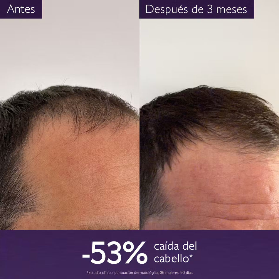 CAUDALIE SERUM CAPILAR ANTICAIDA 50ML