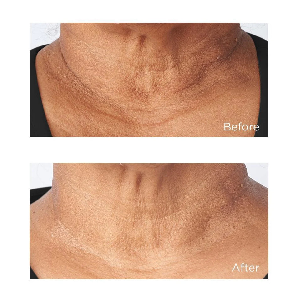PERRICONE COLD PLASMA+ NECK&CHEST 30 ML
