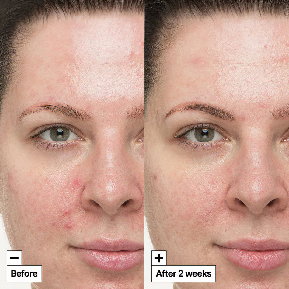 DR.JART+ CICAPAIR SO SOOTHING TREATMENT