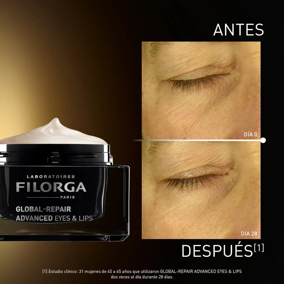 FILORGA GLOBAL REPAIR EYE&LIPS 15ML